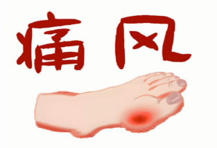 為什么男性更容易痛風